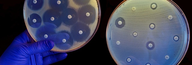 ИИ может обнаружить устойчивость к антибиотикам всего за 30 минут