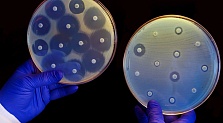 ИИ может обнаружить устойчивость к антибиотикам всего за 30 минут